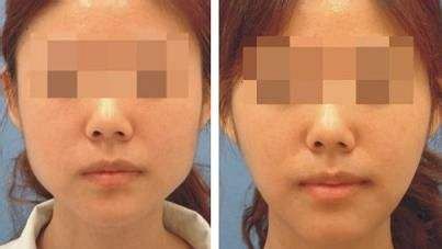 重慶好美整形醫(yī)院深度測評：醫(yī)資力量大揭秘