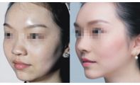 牙齒保護(hù)指南：你對(duì)牙釉質(zhì)的保養(yǎng)有多重視？