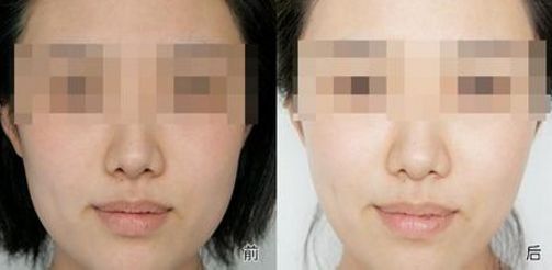 昆明豐胸醫(yī)院排行榜揭秘：前十強(qiáng)院所全面解析