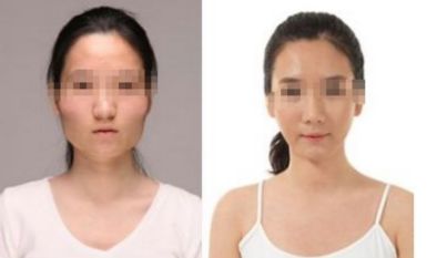 鄭州第五人民醫(yī)院詳解：認識過敏科專家團隊和擅長領域