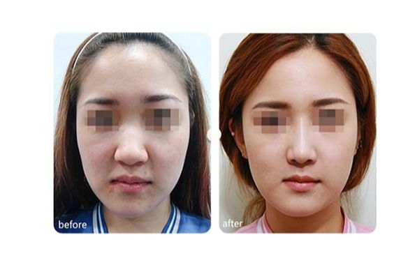 北京空軍總醫(yī)院激光美容中心最新服務(wù)分享