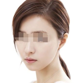 哈爾濱激光美容醫(yī)院推薦，專業(yè)解決肌膚問題
