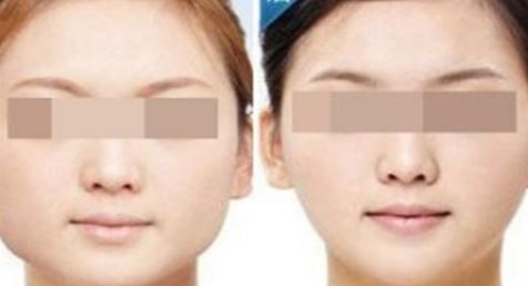 合肥激光整形醫(yī)院排名前十強(qiáng)揭曉