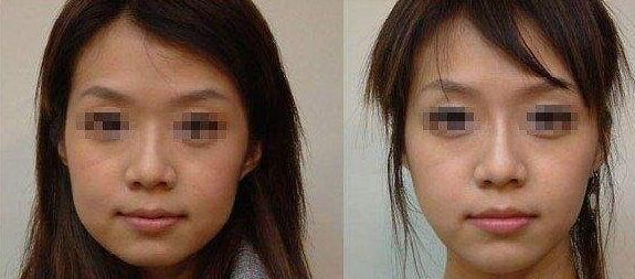 重慶臀部填充醫(yī)院排行榜：10家口碑推薦！