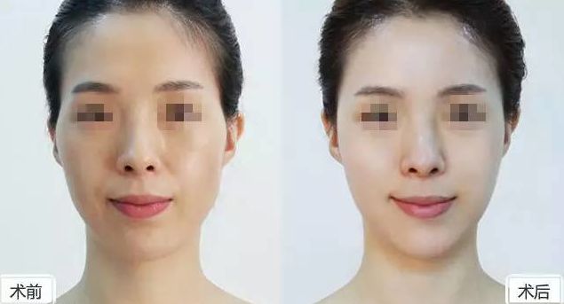 【最新】永康去眼角魚尾紋醫(yī)療整形醫(yī)院排名Top10【專家推薦】