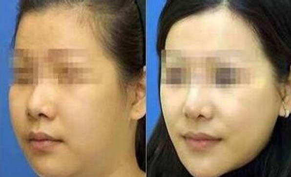 珠海十大吸脂瘦腹醫(yī)院推薦：實(shí)力出眾，效果顯著
