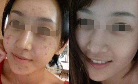 貴陽美容整形實(shí)力醫(yī)院排名揭曉：華美、美萊、利美康入選醫(yī)美前沿