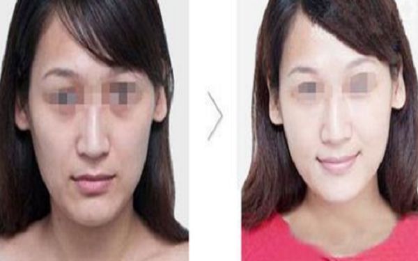 哈爾濱吸脂醫(yī)院排行榜大全：誰的手術(shù)效果讓你驚艷？