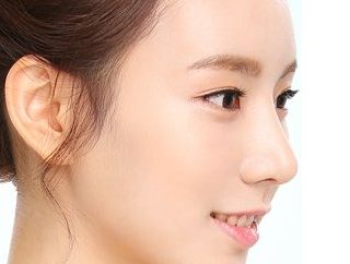 淮南美橙醫(yī)療整形手術(shù)詳解及案例分享