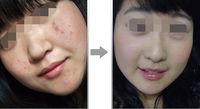 陳瑤正畸醫(yī)生：專注解決青少年顏面發(fā)育問題