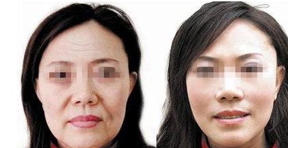 貴陽美貝爾醫(yī)院眼部整形和豐胸服務(wù)質(zhì)量解析