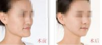 昆明美立方整形醫(yī)院專家介紹：信譽(yù)可靠，值得信賴！