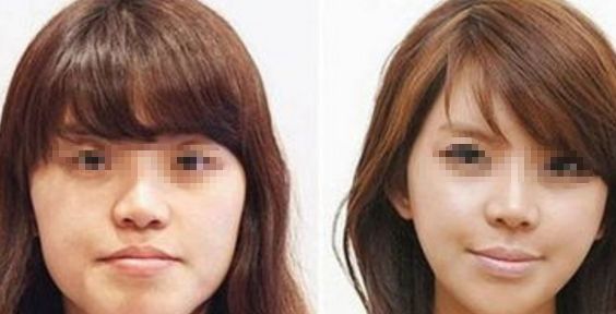 邢臺遇見美：醫(yī)院評價、價格詳解及資料全揭秘