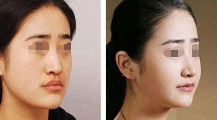 古北悅麗醫(yī)療美容診所評價、詳細介紹及價目表