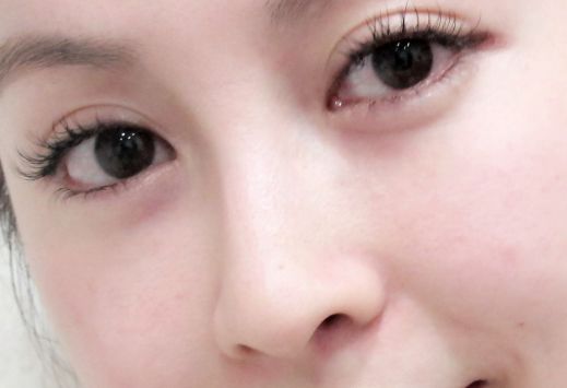 上海腹壁成形術(shù)推薦：華美、玫瑰、九院