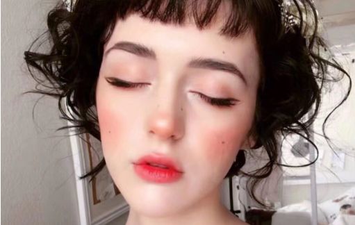 深圳美萊陳芝雙眼皮修復(fù)費(fèi)用、效果如何，值得嘗試