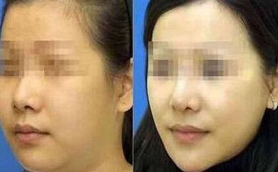 三亞中醫(yī)院眼部整形特色服務(wù)全解析