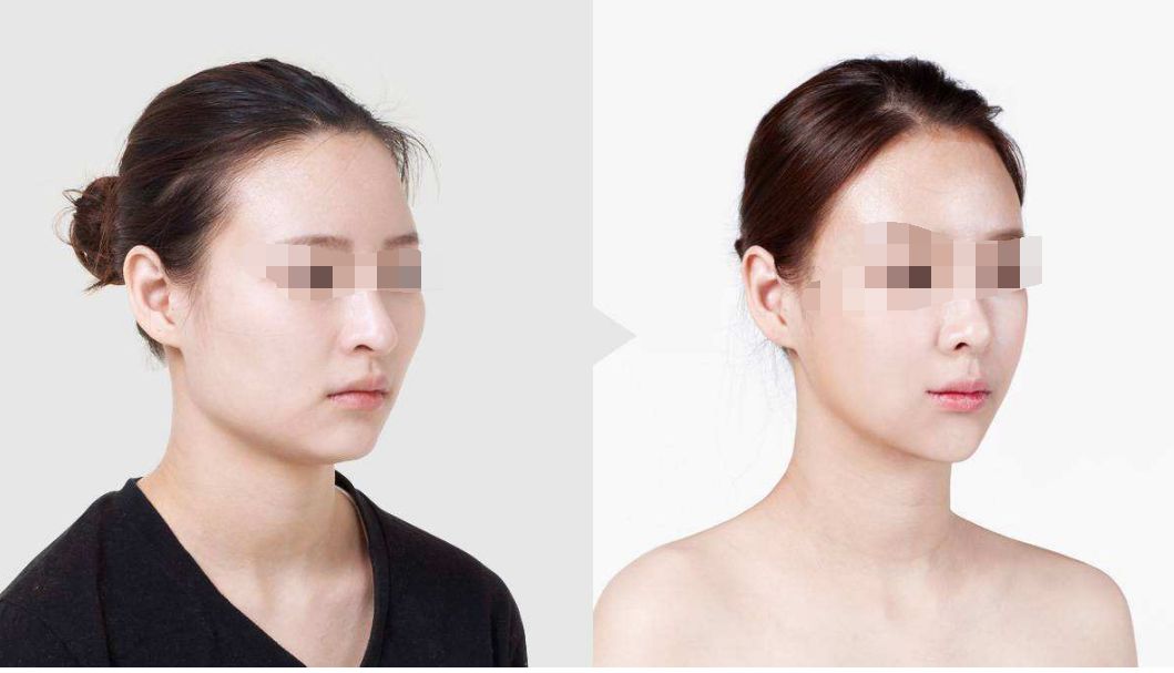 上海宏康整形外科醫(yī)院：權(quán)威認(rèn)證，卓越私密整形