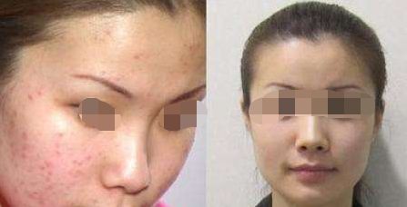 上海港麗醫(yī)療美容門(mén)診評(píng)價(jià)及價(jià)格參考