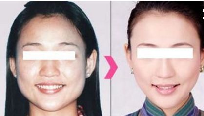 孝感哪家整形醫(yī)院性價(jià)比最高？揭秘華美、韓美、悅?cè)蝗裔t(yī)療美容機(jī)構(gòu)