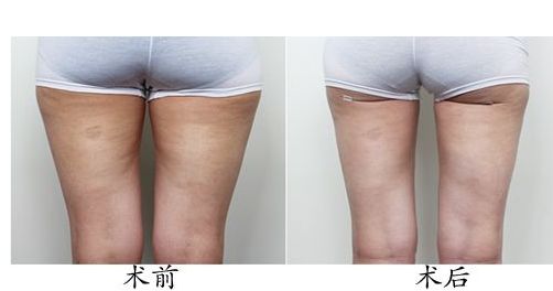 揭秘：誰(shuí)主沉??？全國(guó)鼻整形醫(yī)院權(quán)威排名大公開(kāi)