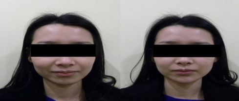 南陽華美植發(fā)中心詳細(xì)介紹及預(yù)約方式，地址電話全公開