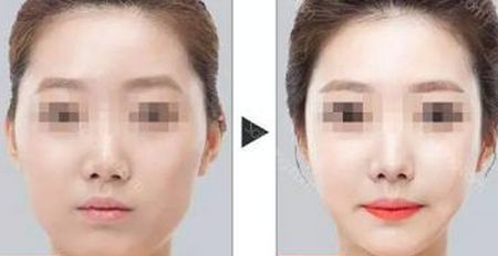 蘭州整形哪家靠譜？皙妍麗整形醫(yī)院值得信賴嗎？