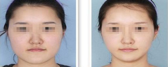 紫潔儷方醫(yī)療美容診所北京預(yù)約電話地址口碑如何？
