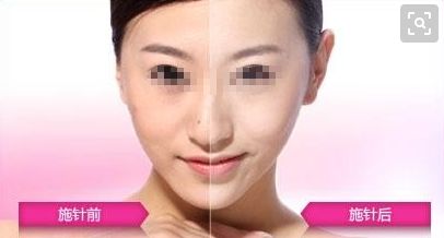 沈陽整形醫(yī)院綜合排行：全面解析正規(guī)整形醫(yī)院列表！