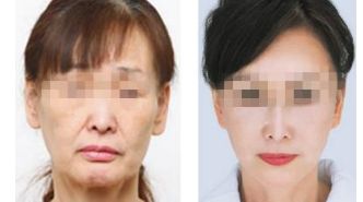 惠州伊麗莎白整形醫(yī)院評價：醫(yī)生資質(zhì)、項目價格全知曉