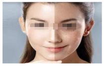 泉州睫毛移植?？漆t(yī)院有哪些？雍禾植發(fā)采用先進(jìn)的數(shù)字化技術(shù)