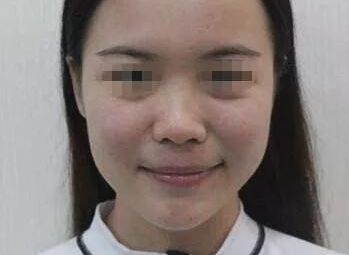 沈陽副乳手術(shù)醫(yī)院排名及費(fèi)用查詢