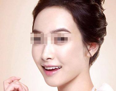 深圳陽光整形口碑體驗(yàn)：三位愛美者親身評(píng)價(jià)