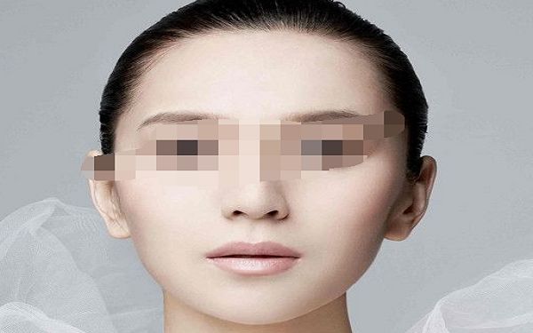 廣州胡葵葵眼袋改善實(shí)錄，輕松解決眼袋困擾