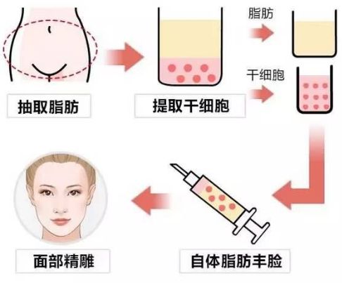 沈陽(yáng)何氏眼科醫(yī)院口碑怎么樣？深度剖析+真實(shí)案例