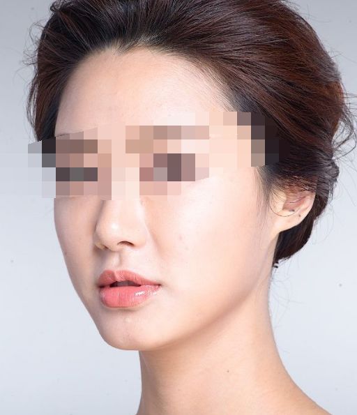 00后整容風(fēng)潮興起：醫(yī)美市場悄然變天