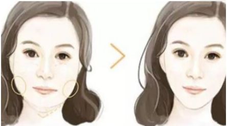 北京哪家醫(yī)院的拉皮手術效果好？技術領先的醫(yī)院有曹正東、黃寅守