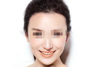 北京王馳拉皮手術(shù)的技術(shù)與效果如何？