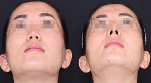 呼和浩特吳老貴醫(yī)學(xué)美容診所深入剖析：從資歷到價目全解