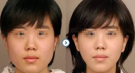 北京安陽整形醫(yī)生的評價及項(xiàng)目介紹
