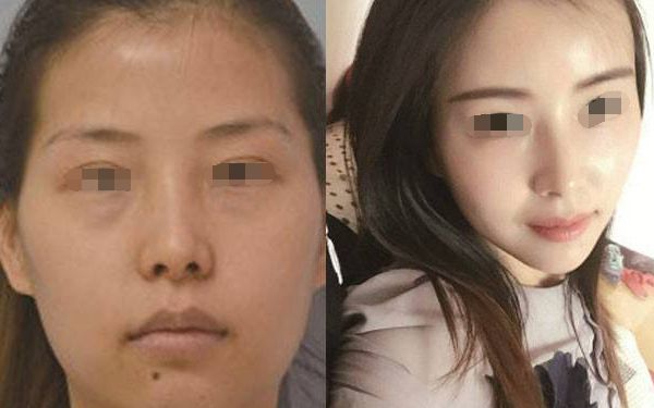 西安美萊拉皮效果如何？院址位于西安市蓮湖區(qū)，成立于2016年