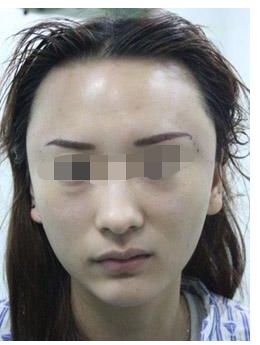 探索楊水斌醫(yī)生鼻綜合整形技術(shù)，解析優(yōu)勢(shì)與收費(fèi)合理性