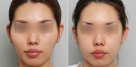 伊美爾幸福整形：北京高品質(zhì)整形醫(yī)院，價(jià)格透明