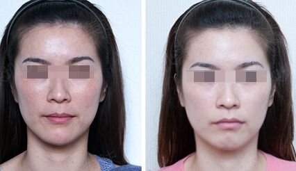 沈陽友誼美容醫(yī)院評價與資質(zhì)解析，打造您的美麗計劃