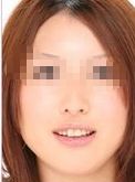 貴陽華醫(yī)疤痕科專家分享妊娠紋修復(fù)經(jīng)驗，快來了解！