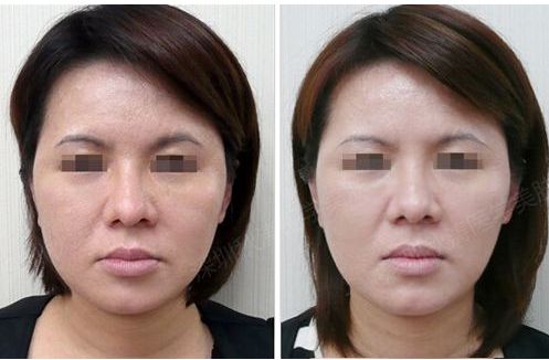 衢州市哪家醫(yī)院有專業(yè)的眼部抗衰科室？