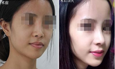 嘉興海寧市人民醫(yī)院燒傷科醫(yī)生團隊實力解析