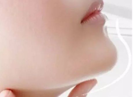 長沙美萊整容醫(yī)院：隆胸吸脂案例詳解，醫(yī)生服務(wù)貼心可靠