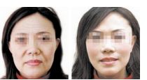 深圳正頜手術醫(yī)院排名：術前必備資料和須知