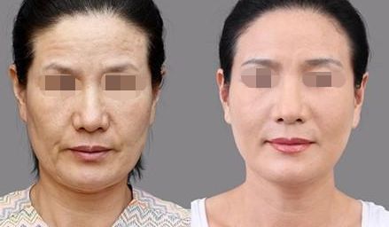 我來匯總！?？诙浌锹”轻t(yī)院推薦榜